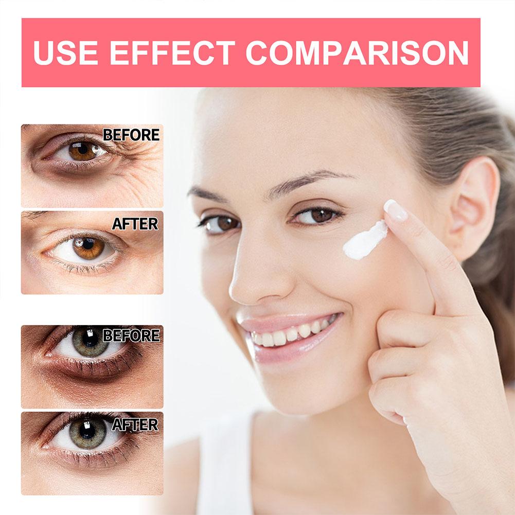 Retinol Eye Cream Lightening D - огляд і ціна Milk Thistle Silymarin